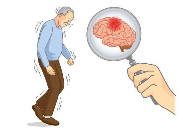 引起老年人脑血栓的原因有哪些