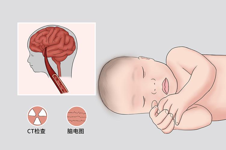  新生儿缺氧脑损伤需要多长时间？ 